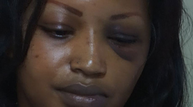 Ruth Gakii who is admitted to the Nairobi Women's Hospital has accused the father of her three-year-old son, a UN employee of Papua New Guinean origin, of having assaulted her to no consequence despite reports filed with the police.