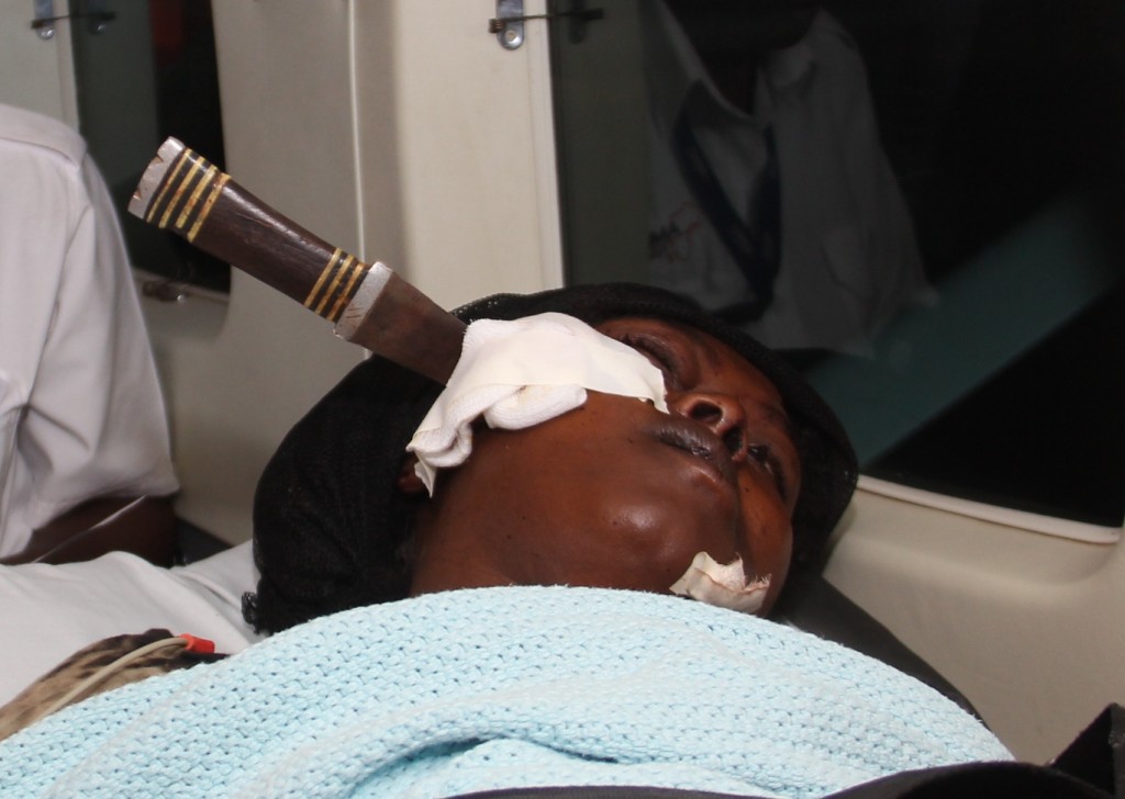 Fourteen hours later, a long knife was lodged on her right cheek as she waited to be airlifted from to Nairobi/MIKE KARIUKI