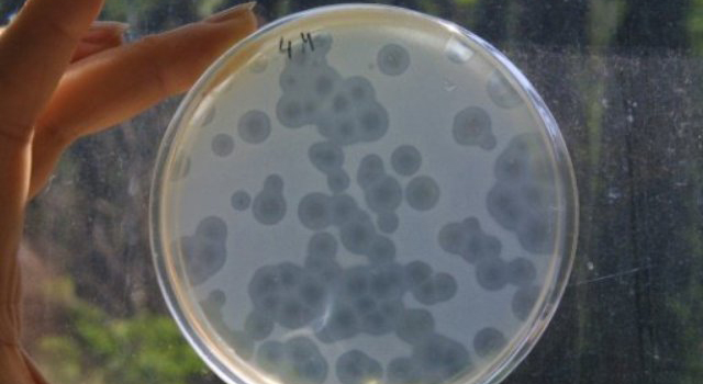 Staphylococcus is a common bacteria which can cause anything from a simple boil to horrible flesh-eating infections/AFP