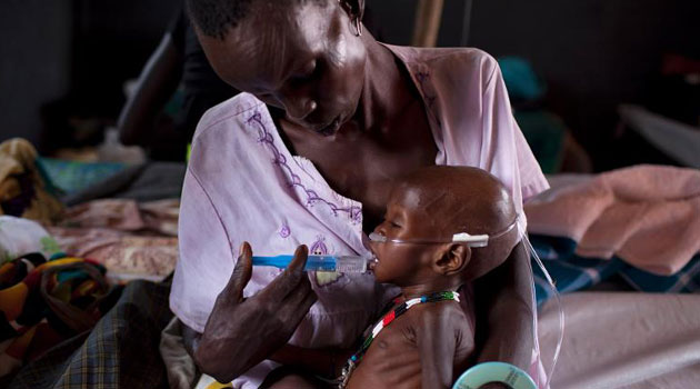 S.Sudan grappling with malnutrition/FILE