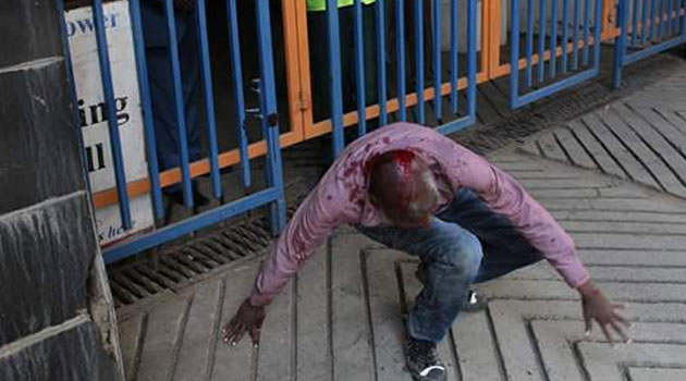 Activist Japheth Moroko seen here after being battered by the police/COURTESY