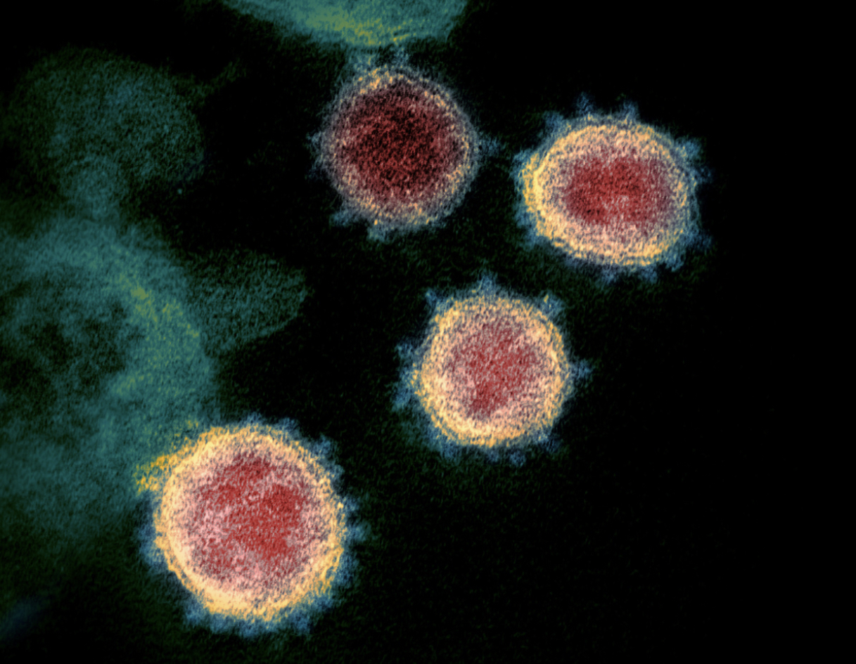 Evidence shows coronavirus evolved in nature » Capital News