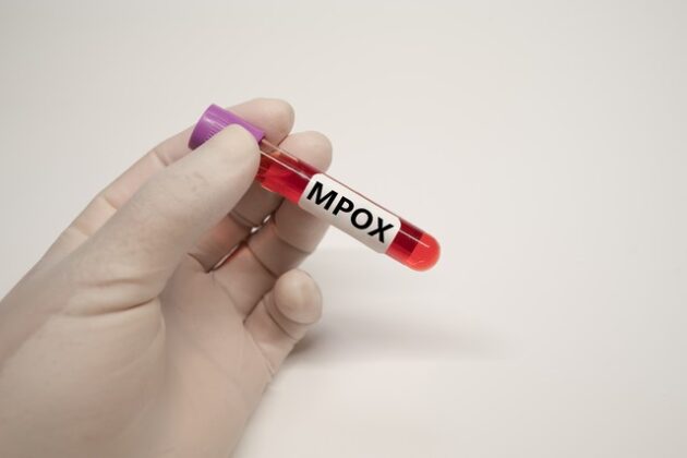Africa CDC allocates 2,000 doses of mpox vaccine to Uganda