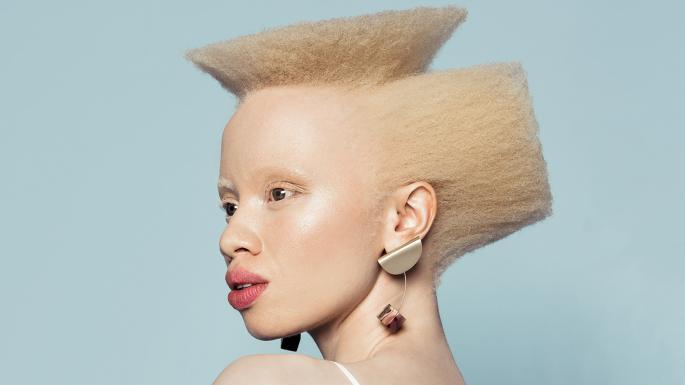 South African model makes history as the first Albino woman to cover Vogue  - The Sauce