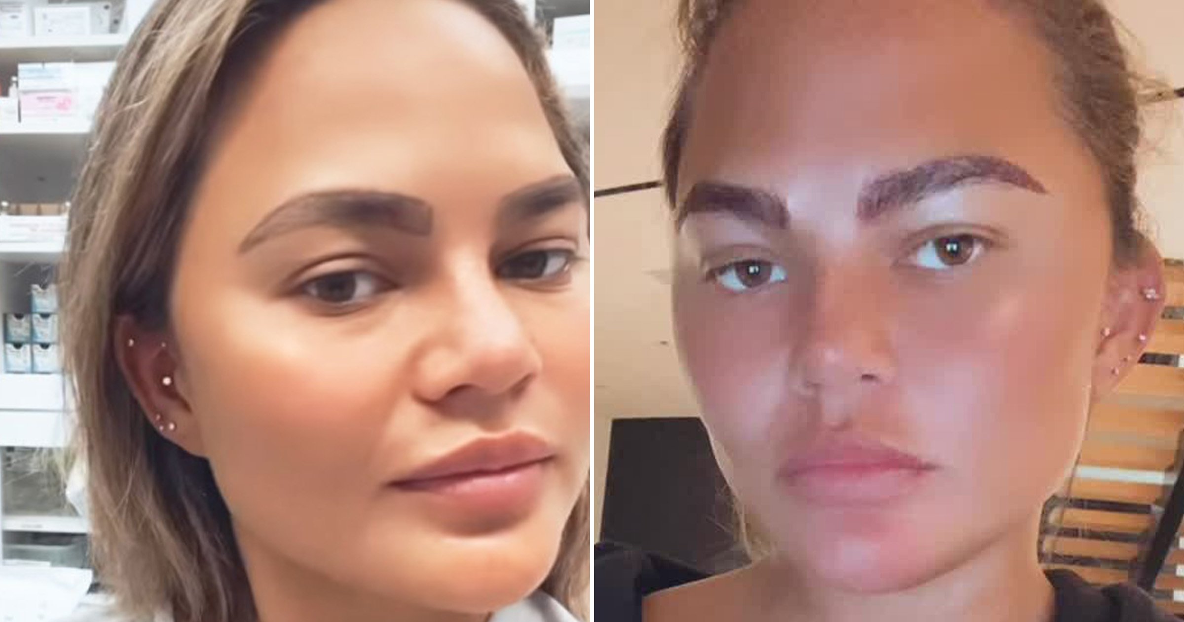 ChrissyTeigenEyebrowTransplant The Sauce